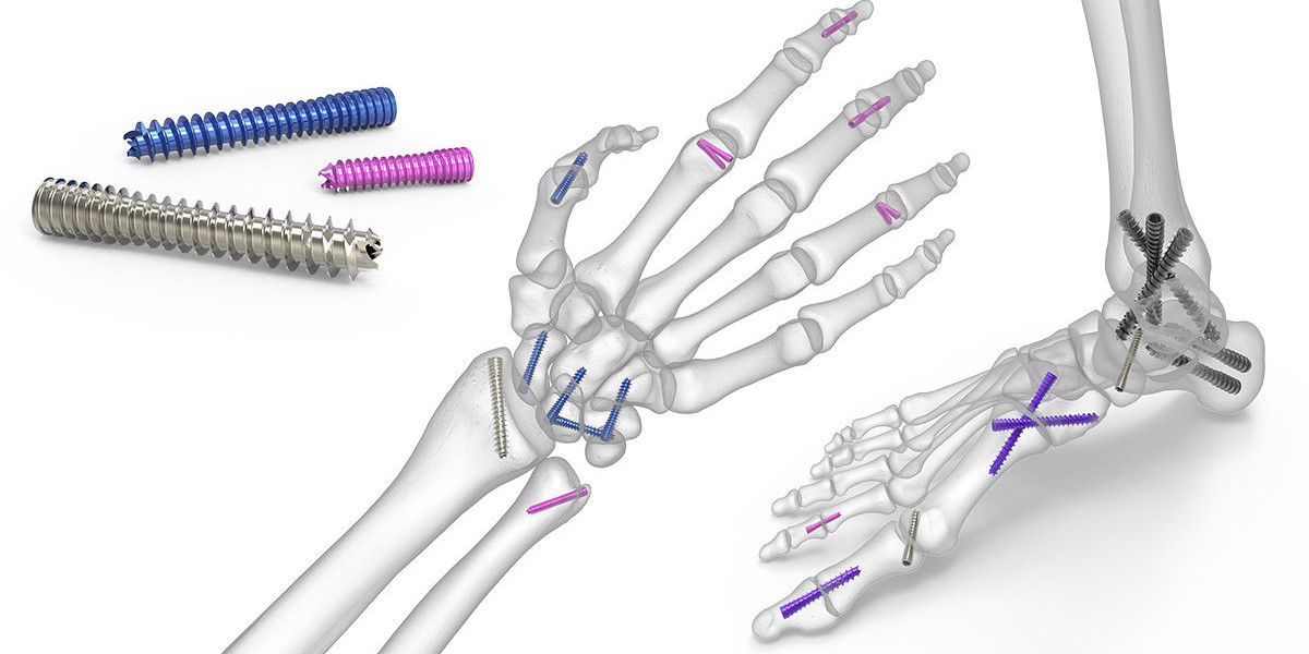 Fracture Fixation Products Market Size to Grow at 6.30% CAGR during the Forecast Period 2022 to 2030