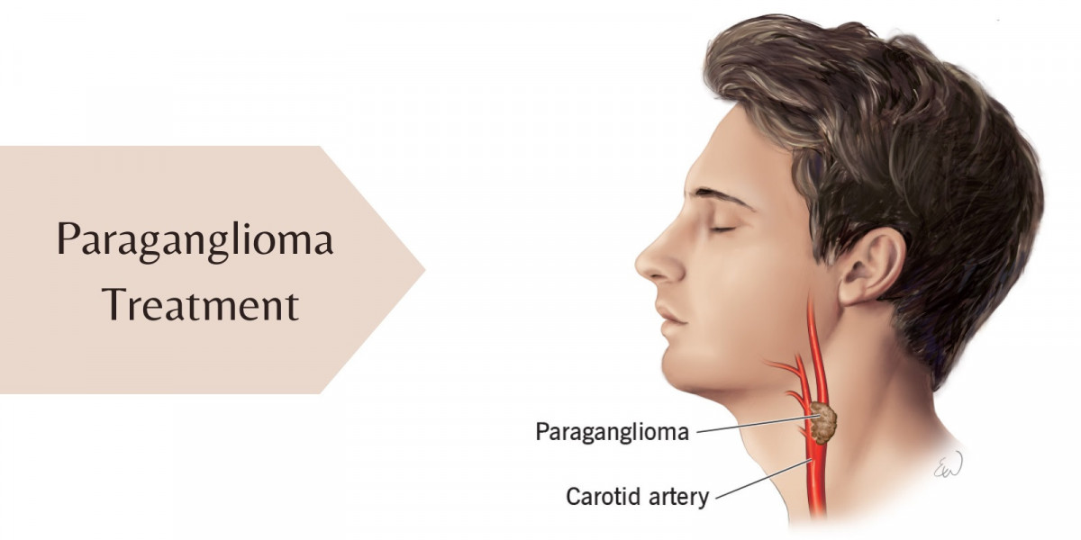 Paraganglioma Market Players Share is Expected to Witness Higher Growth